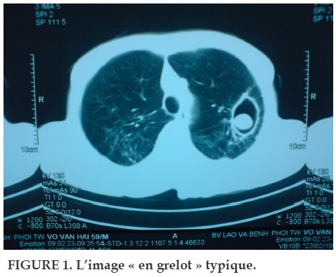 Journal Of Functional Ventilation And Pulmonology Journal De La Fonction Ventilatoire Et De Pneumologie